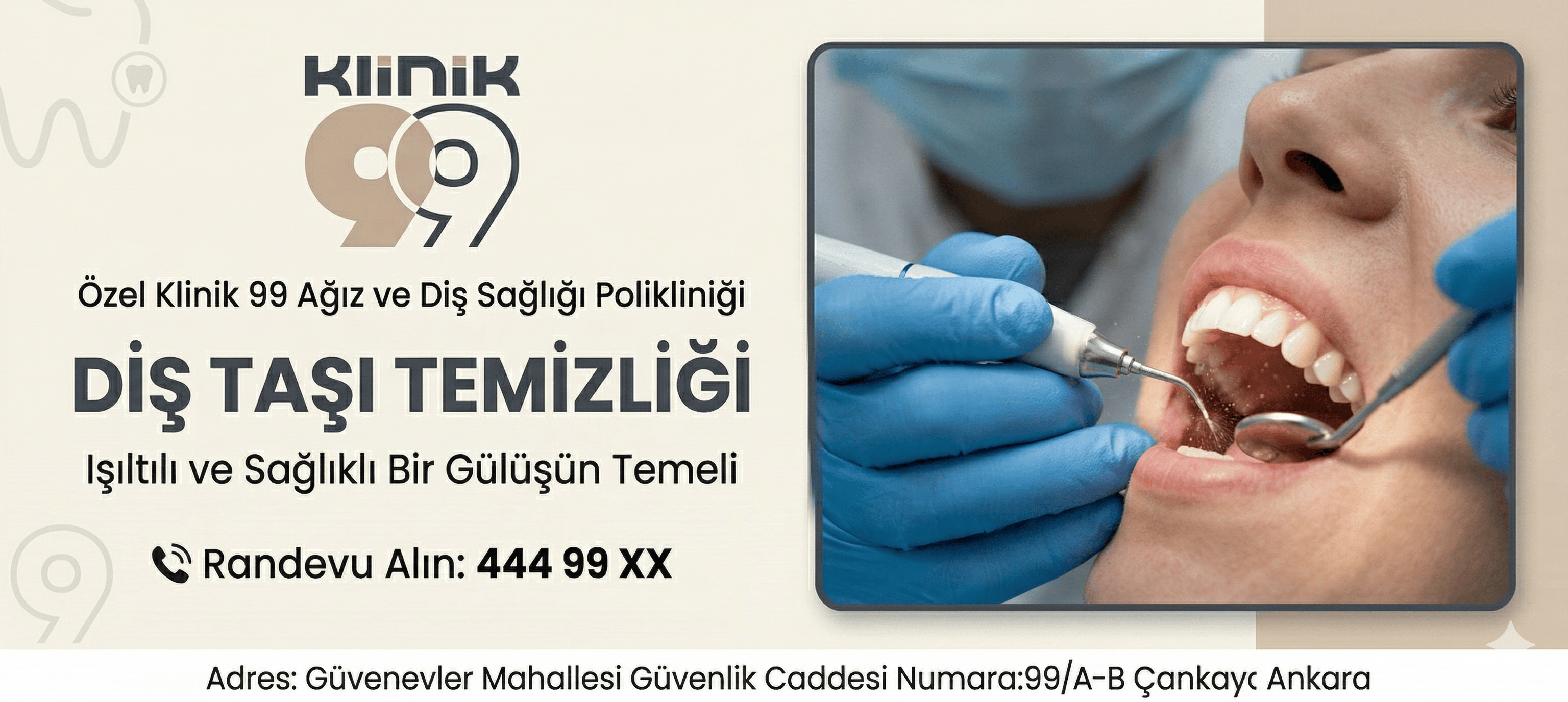 Diş Taşı Temizliği - Ankara - Çankaya